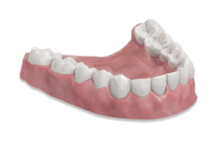 Vollprothese/Gebiss